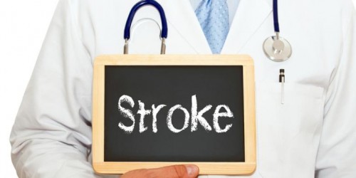 Mengenal dan Mencegah Stroke
