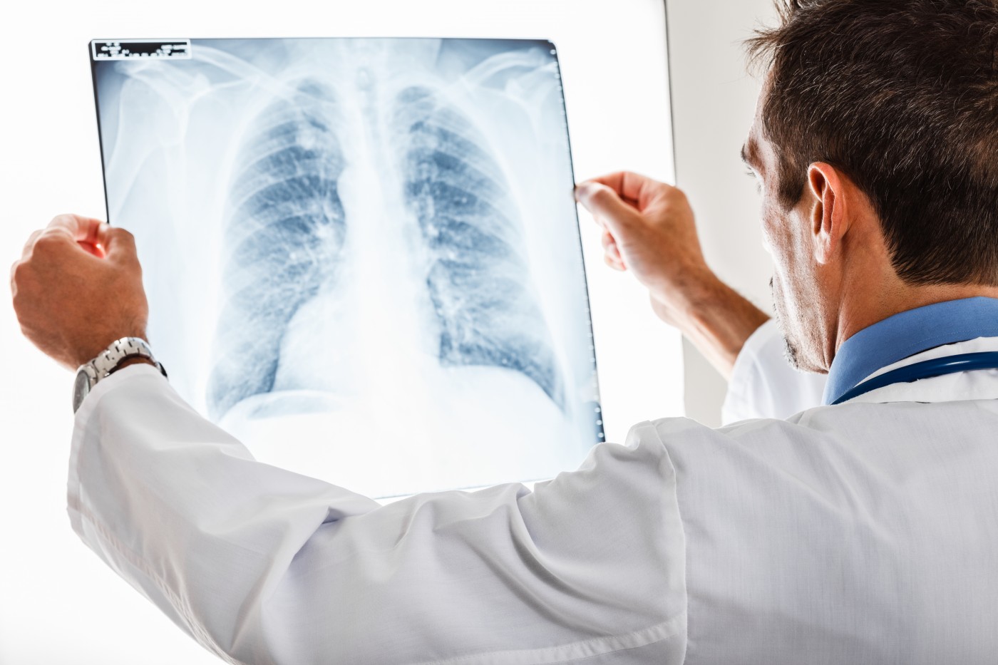 Pentingnya Melakukan Rontgen Dada (Thorax)